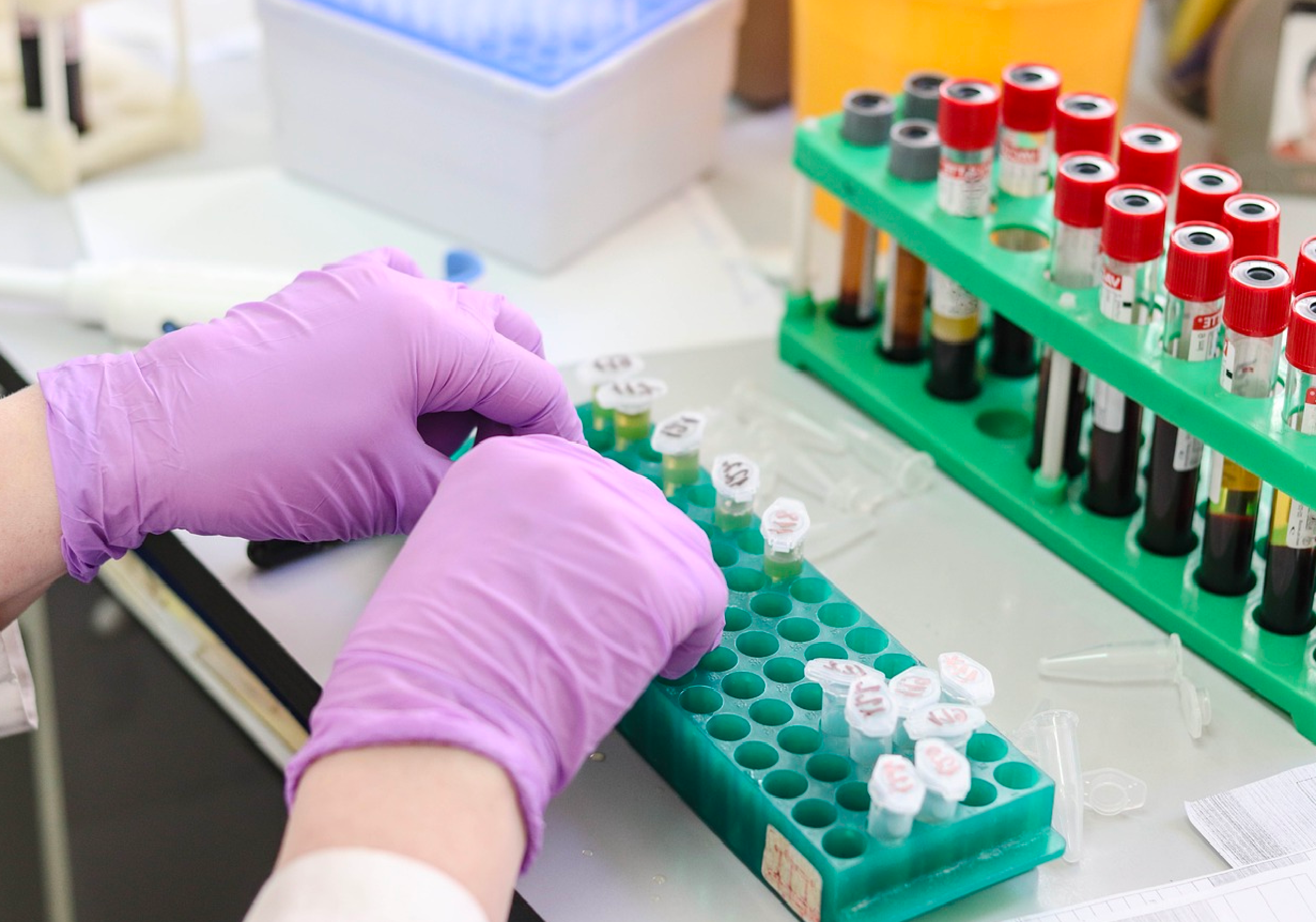 Lab Testing Box: Gloved hands organizing labeled test tubes in a lab, surrounded by blood vials in racks, representing lab testing services.